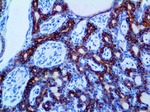 IHC of Cytokeratin LMW/AE1 on a FFPE Salivary Gland